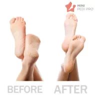 Zestaw do pedicure MINI Pedi Pro